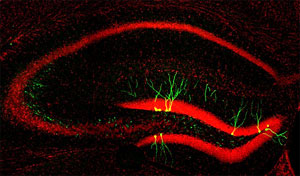 Generación de nuevas neuronas en el giro dentado (neurogénesis), identificada mediante el uso de vectores retrovirales y la expresión de la proteína verde fluorescente Venus. Los núcleos celulares y la anatomía del hipocampo se pueden observar en rojo (Topro3)