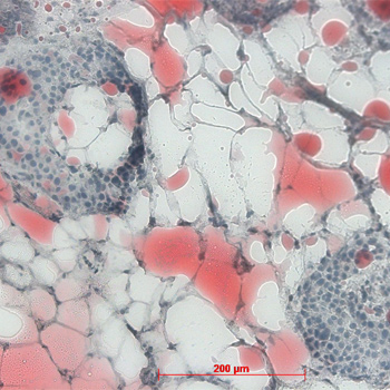 Células adiposas (blanco / rojo teñido) junto a un islote productor de insulina en el páncreas. / IDM (Universidad de Tubingen)