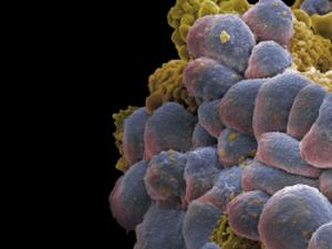 Celulas de cáncer de mama. / Francisco Bengoa (FLICKR)