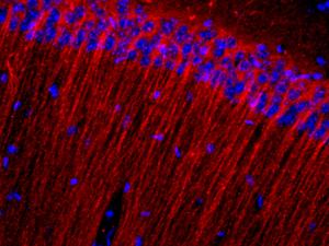 Células nerviosas del cuerno de ammon en el hipocampo. /  red forest (FLICKR)
