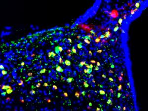 Imagen de microscopía de fluorescencia del núcleo arcuado del hipotálamo donde se aprecian, en color verde, las neuronas POMC. / Alicia G Gómez-Valadés