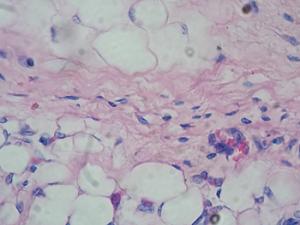 Identifican el papel de la proteína survivina en la expansión patológica del tejido adiposo
