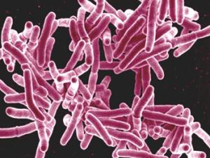 Micrografía de la bacteria Mycobacterium tuberculosis. / NIAID (FLICKR)