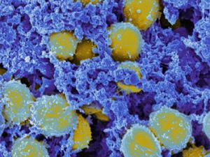 Micrografía de bacterias Stpahylococcus aureus. / NIAID (FLICKR)