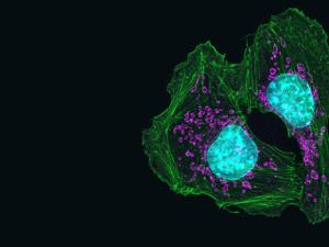 Células de cáncer de piel en ratones. / PROZEISS Microscopy (FLICKR)