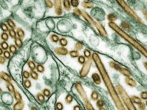 Orthomyxoviridae, H5N1. Influenza A H5N1 (dorado) creciendo en células MDCK (verde). / Cynthia Goldsmith (WIKIPEDIA)