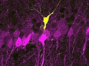 Una nueva técnica aísla la actividad neuronal durante la consolidación de la memoria
