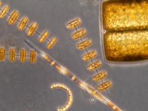 Células de diatomeas observadas al microscopio. / Isabel G. Teixeira