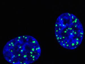 Roturas del ADN (puntos verdes) en el núcleo de células tratadas con un agente de quimioterapia. / F.C.