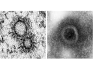 Vesículas con moléculas del genoma del virus de la gripe. / Fernández y Risco / Sachse (CSIC)