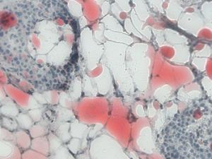 Células adiposas (blanco / rojo teñido) junto a un islote productor de insulina en el páncreas. / IDM (Universidad de Tubingen)