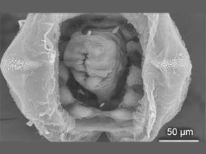 Vista ventral con microscopio electrónico de un ejemplar recién nacido de la especie Unio mancus. / MNCN-CSIC
