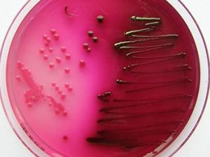Una nanopartícula revestida con antibiótico elimina bacterias resistente