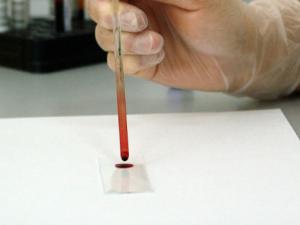 Desarrollan un dispositivo para controlar los niveles de potasio en una gota de sangre. / PublicDomainPictures (PIXABAY)