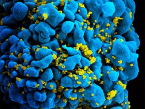 Micrografía electrónica de una célula T infectada por VIH. / NIAID (FLICKR)