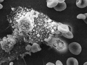 La plasticidad de los macrófagos permite reparar tejidos del pulmón y del hígado