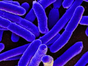 Micrografía electrónica de barrido coloreada de Escherichia coli. / NIAID (Flickr)